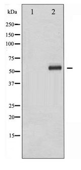 ELK1 Antibody - Western blot of Elk1 phosphorylation expression in UV treated HeLa whole cell lysates,The lane on the left is treated with the antigen-specific peptide.