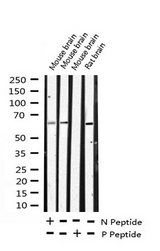 ELK1 Antibody - Western blot analysis of Phospho-Elk1 (Ser383) expression in various lysates