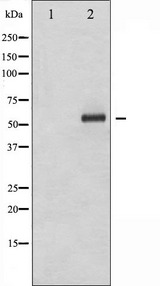ELK1 Antibody - Western blot analysis of Elk1 phosphorylation expression in UV treated HeLa whole cells lysates. The lane on the left is treated with the antigen-specific peptide.