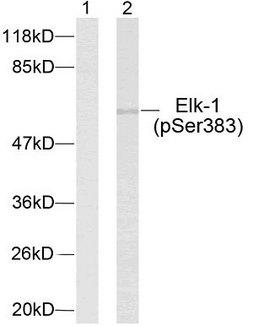 ELK1 Antibody - Western blot analysis of extracts using Elk-1 (Phospho-Ser383) Antibody.Line1: The extracts from HeLa cells untreated; Line2: The extracts from HeLa cells treated with UV.