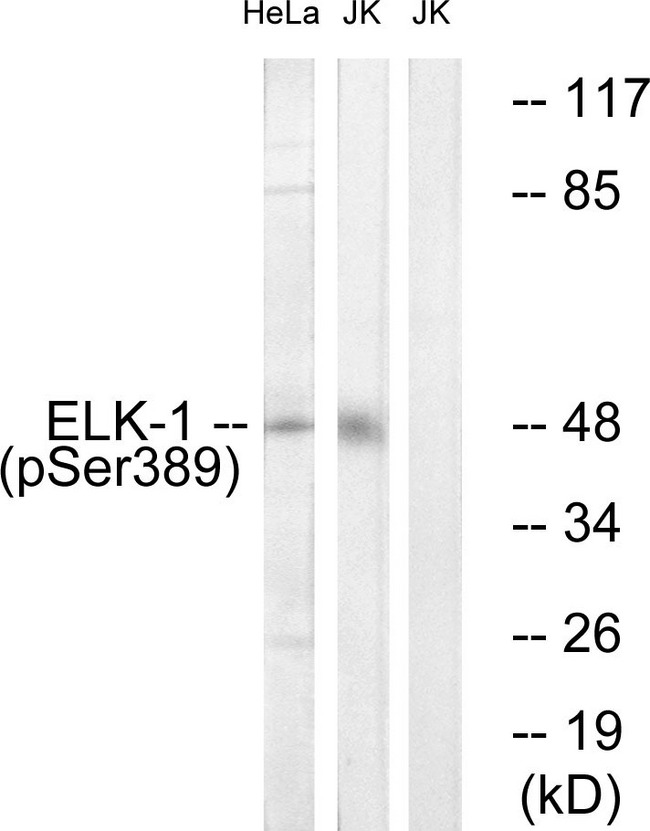 ELK1 Antibody - Western blot analysis of lysates from Jurkat cells treated with UV 15' and HeLa cells treated with paclitaxel 1uM 24h, using Elk1 (Phospho-Ser389) Antibody. The lane on the right is blocked with the phospho peptide.