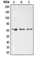 ELK1 Antibody - Western blot analysis of ELK1 (pS389) expression in HT29 (A); HeLa (B); Jurkat (C) whole cell lysates.