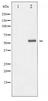 ELK1 Antibody - Western blot of Elk1 phosphorylation expression in UV treated Jurkat whole cell lysates,The lane on the left is treated with the antigen-specific peptide.