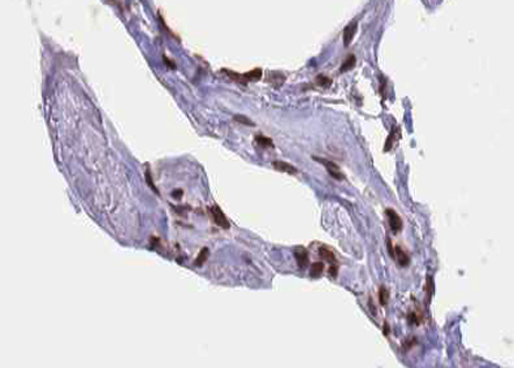 ELK1 Antibody - 1:100 staining human lung tissue by IHC-P. The tissue was formaldehyde fixed and a heat mediated antigen retrieval step in citrate buffer was performed. The tissue was then blocked and incubated with the antibody for 1.5 hours at 22°C. An HRP conjugated goat anti-rabbit antibody was used as the secondary.