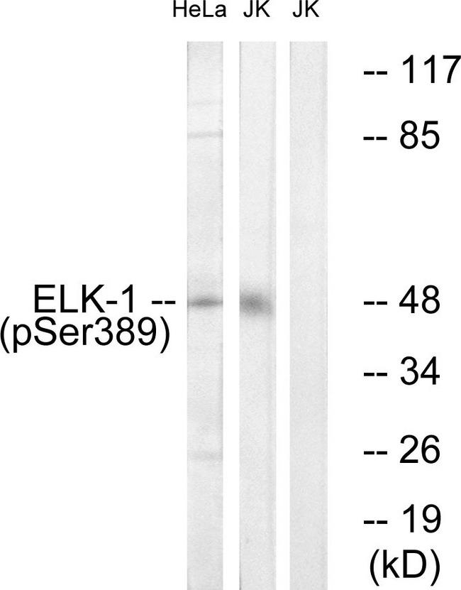 ELK1 Antibody - Western blot analysis of extracts from Jurkat cells treated with UV (15mins) and HeLa cells treated with paclitaxel (1uM, 24hours), using Elk1 (Phospho-Ser389) antibody.