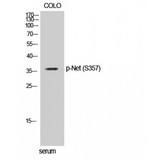 ELK3 / NET Antibody - Western blot of Phospho-Net (S357) antibody