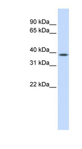 ELK3 / NET Antibody - ELK3 / NET antibody Western blot of Fetal Liver lysate. This image was taken for the unconjugated form of this product. Other forms have not been tested.
