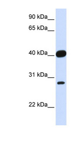 ELK3 / NET Antibody - ELK3 / NET antibody Western blot of Fetal Heart lysate. This image was taken for the unconjugated form of this product. Other forms have not been tested.