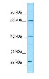 ELK3 / NET Antibody - ELK3 / NET antibody Western Blot of Rat Thymus.  This image was taken for the unconjugated form of this product. Other forms have not been tested.