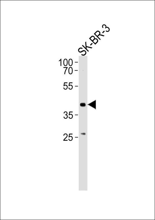 ELK3 / NET Antibody - ELK3 Antibody western blot of SK-BR-3 cell line lysates (35 ug/lane). The ELK3 antibody detected the ELK3 protein (arrow).