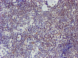 ELK3 / NET Antibody - IHC of paraffin-embedded Human lymphoma tissue using anti-ELK3 mouse monoclonal antibody. (Heat-induced epitope retrieval by 10mM citric buffer, pH6.0, 100C for 10min).