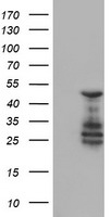 ELK3 / NET Antibody - HEK293T cells were transfected with the pCMV6-ENTRY control (Left lane) or pCMV6-ENTRY ELK3 (Right lane) cDNA for 48 hrs and lysed. Equivalent amounts of cell lysates (5 ug per lane) were separated by SDS-PAGE and immunoblotted with anti-ELK3.