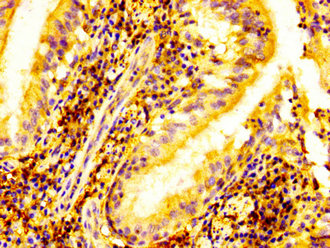 ELK3 / NET Antibody - Immunohistochemistry image at a dilution of 1:500 and staining in paraffin-embedded human lung tissue performed on a Leica BondTM system. After dewaxing and hydration, antigen retrieval was mediated by high pressure in a citrate buffer (pH 6.0) . Section was blocked with 10% normal goat serum 30min at RT. Then primary antibody (1% BSA) was incubated at 4 °C overnight. The primary is detected by a biotinylated secondary antibody and visualized using an HRP conjugated SP system.