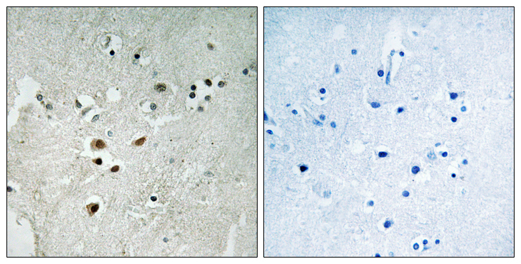 ELK3 / NET Antibody - Immunohistochemistry analysis of paraffin-embedded human brain, using Elk3 (Phospho-Ser357) Antibody. The picture on the right is blocked with the phospho peptide.
