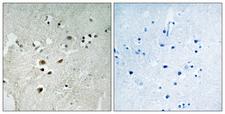 ELK3 / NET Antibody - Immunohistochemistry analysis of paraffin-embedded human brain, using Elk3 (Phospho-Ser357) Antibody. The picture on the right is blocked with the phospho peptide.