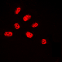 ELK3 / NET Antibody - Immunofluorescent analysis of NET (pS357) staining in HUVEC cells. Formalin-fixed cells were permeabilized with 0.1% Triton X-100 in TBS for 5-10 minutes and blocked with 3% BSA-PBS for 30 minutes at room temperature. Cells were probed with the primary antibody in 3% BSA-PBS and incubated overnight at 4 C in a humidified chamber. Cells were washed with PBST and incubated with a DyLight 594-conjugated secondary antibody (red) in PBS at room temperature in the dark. DAPI was used to stain the cell nuclei (blue).