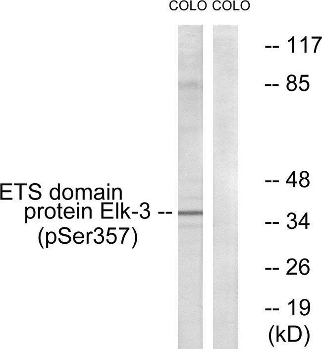 ELK3 / NET Antibody - Western blot analysis of extracts from COLO cells, treated with serum (20%, 15mins), using ETS Domain Protein Elk-3 (Phospho-Ser357) antibody.
