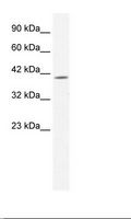 ELK4 Antibody - Jurkat Cell Lysate.  This image was taken for the unconjugated form of this product. Other forms have not been tested.