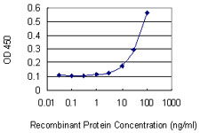 ELK4 Antibody - Detection limit for recombinant GST tagged ELK4 is 3 ng/ml as a capture antibody.
