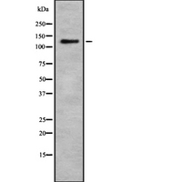 ELKS / ERC1 Antibody - Western blot analysis of RB6I2 expression in HEK293 cells. The lane on the left is treated with the antigen-specific peptide.