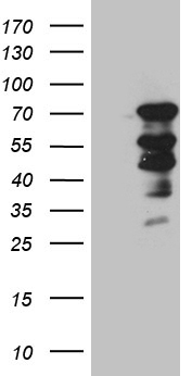 ELL / MEN Antibody - HEK293T cells were transfected with the pCMV6-ENTRY control. (Left lane) or pCMV6-ENTRY ELL. (Right lane) cDNA for 48 hrs and lysed. Equivalent amounts of cell lysates. (5 ug per lane) were separated by SDS-PAGE and immunoblotted with anti-ELL. (1:2000)