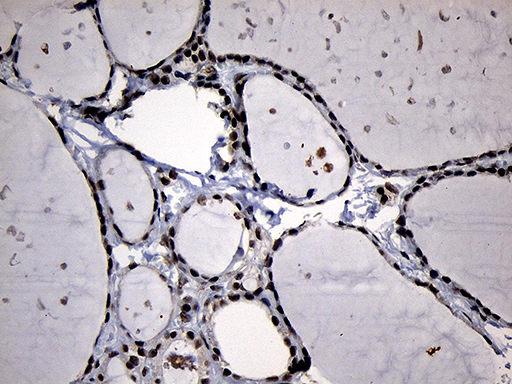 ELL / MEN Antibody - Immunohistochemical staining of paraffin-embedded Human thyroid tissue within the normal limits using anti-ELL mouse monoclonal antibody. (Heat-induced epitope retrieval by 1mM EDTA in 10mM Tris buffer. (pH8.5) at 120°C for 3 min. (1:150)
