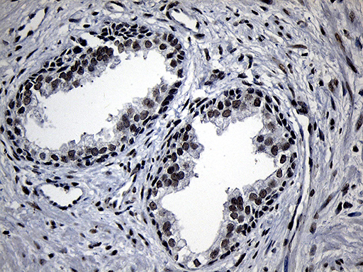 ELL / MEN Antibody - Immunohistochemical staining of paraffin-embedded Human prostate tissue within the normal limits using anti-ELL mouse monoclonal antibody. (Heat-induced epitope retrieval by 1mM EDTA in 10mM Tris buffer. (pH8.5) at 120°C for 3 min. (1:150)