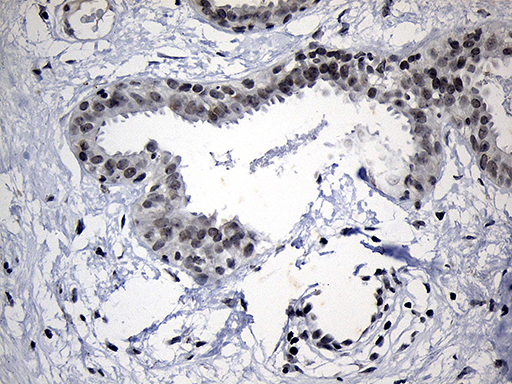 ELL / MEN Antibody - Immunohistochemical staining of paraffin-embedded Human breast tissue within the normal limits using anti-ELL mouse monoclonal antibody. (Heat-induced epitope retrieval by 1mM EDTA in 10mM Tris buffer. (pH8.5) at 120°C for 3 min. (1:150)