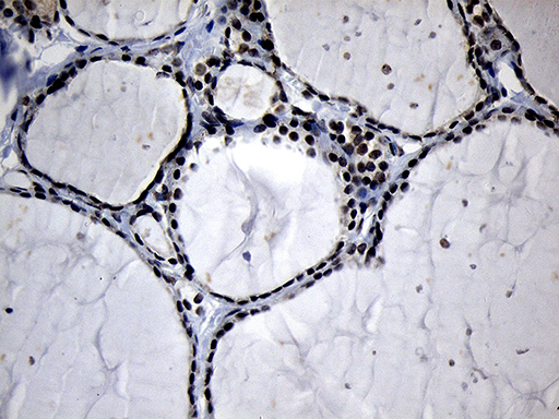 ELL / MEN Antibody - Immunohistochemical staining of paraffin-embedded Human thyroid tissue within the normal limits using anti-ELL mouse monoclonal antibody. (Heat-induced epitope retrieval by 1mM EDTA in 10mM Tris buffer. (pH8.5) at 120°C for 3 min. (1:150)