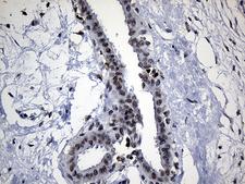 ELL / MEN Antibody - Immunohistochemical staining of paraffin-embedded Human breast tissue within the normal limits using anti-ELL mouse monoclonal antibody. (Heat-induced epitope retrieval by 1mM EDTA in 10mM Tris buffer. (pH8.5) at 120°C for 3 min. (1:500)