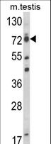 ELL / MEN Antibody - Western blot of ELL Antibody in mouse testis tissue lysates (35 ug/lane). ELL (arrow) was detected using the purified antibody.