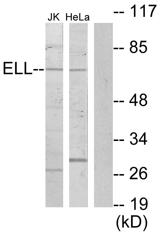 ELL / MEN Antibody - Western blot analysis of lysates from Jurkat and HeLa cells, using ELL Antibody. The lane on the right is blocked with the synthesized peptide.