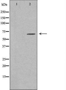 ELL / MEN Antibody - Western blot analysis of extracts of Jurkat cells using ELL antibody. The lane on the left is treated with the antigen-specific peptide.