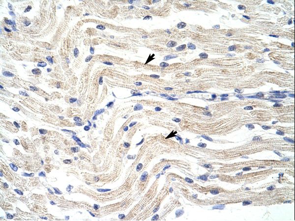 ELL / MEN Antibody - ELL antibody ARP38813_T100-NP_006523-ELL (elongation factor RNA polymerase II) Antibody was used in IHC to stain formalin-fixed, paraffin-embedded human muscle.  This image was taken for the unconjugated form of this product. Other forms have not been tested.