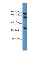ELMO1 / ELMO 1 Antibody - ELMO1 antibody Western blot of HepG2 cell lysate.  This image was taken for the unconjugated form of this product. Other forms have not been tested.