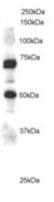 ELMO1 / ELMO 1 Antibody - Antibody staining (1 ug/ml) of Jurkat lysate (RIPA buffer, 35 ug total protein per lane). Primary incubated for 1 hour. Detected by Western blot of chemiluminescence.