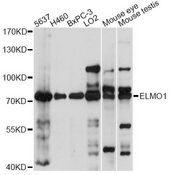 ELMO1 / ELMO 1 Antibody - Western blot analysis of extracts of various cell lines, using ELMO1 antibody at 1:1000 dilution. The secondary antibody used was an HRP Goat Anti-Rabbit IgG (H+L) at 1:10000 dilution. Lysates were loaded 25ug per lane and 3% nonfat dry milk in TBST was used for blocking. An ECL Kit was used for detection and the exposure time was 60s.