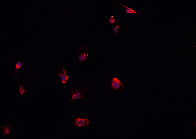 ELMO1 / ELMO 1 Antibody - Staining HepG2 cells by IF/ICC. The samples were fixed with PFA and permeabilized in 0.1% Triton X-100, then blocked in 10% serum for 45 min at 25°C. The primary antibody was diluted at 1:200 and incubated with the sample for 1 hour at 37°C. An Alexa Fluor 594 conjugated goat anti-rabbit IgG (H+L) antibody, diluted at 1/600, was used as secondary antibody.