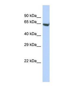 ELMO3 Antibody - Western blot of Human Liver tumor. ELMO3 antibody dilution 1.0 ug/ml.  This image was taken for the unconjugated form of this product. Other forms have not been tested.