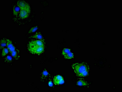 ELMO3 Antibody - Immunofluorescent analysis of MCF-7 cells at a dilution of 1:100 and Alexa Fluor 488-congugated AffiniPure Goat Anti-Rabbit IgG(H+L)