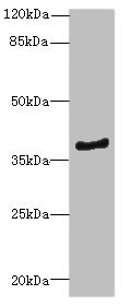 ELMOD1 Antibody - Western blot All Lanes: ELMOD1antibody at 0.7ug/ml+ Mouse kidney tissue Goat polyclonal to rabbit at 1/10000 dilution Predicted band size: 40,23,39 kDa Observed band size: 39 kDa