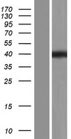 ELMOD1 Protein - Western validation with an anti-DDK antibody * L: Control HEK293 lysate R: Over-expression lysate