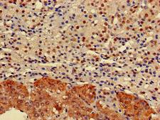 ELMOD2 Antibody - Immunohistochemistry of paraffin-embedded human adrenal gland tissue at dilution of 1:100