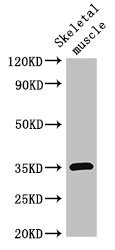 ELMOD2 Antibody - Western Blot Positive WB detected in:Mouse skeletal muscle tissue All Lanes:ELMOD2 antibody at 3µg/ml Secondary Goat polyclonal to rabbit IgG at 1/50000 dilution Predicted band size: 35 KDa Observed band size: 35 KDa
