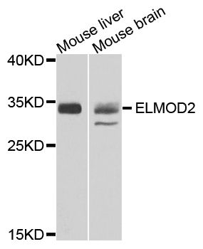 ELMOD2 Antibody - Western blot analysis of extracts of various cell lines, using ELMOD2 antibody at 1:500 dilution. The secondary antibody used was an HRP Goat Anti-Rabbit IgG (H+L) at 1:10000 dilution. Lysates were loaded 25ug per lane and 3% nonfat dry milk in TBST was used for blocking. An ECL Kit was used for detection and the exposure time was 90s.
