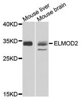 ELMOD2 Antibody - Western blot analysis of extracts of various cell lines, using ELMOD2 antibody at 1:500 dilution. The secondary antibody used was an HRP Goat Anti-Rabbit IgG (H+L) at 1:10000 dilution. Lysates were loaded 25ug per lane and 3% nonfat dry milk in TBST was used for blocking. An ECL Kit was used for detection and the exposure time was 90s.