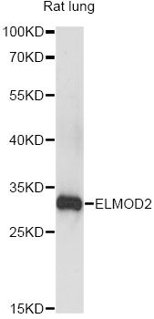 ELMOD2 Antibody - Western blot analysis of extracts of rat lung, using ELMOD2 antibody at 1:3000 dilution. The secondary antibody used was an HRP Goat Anti-Rabbit IgG (H+L) at 1:10000 dilution. Lysates were loaded 25ug per lane and 3% nonfat dry milk in TBST was used for blocking. An ECL Kit was used for detection and the exposure time was 5s.