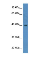 ELMOD3 Antibody - ELMOD3 / RBED1 antibody Western blot of Fetal Lung lysate.  This image was taken for the unconjugated form of this product. Other forms have not been tested.