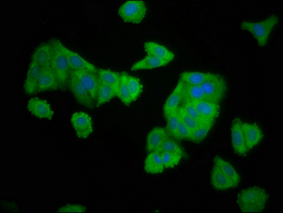 ELMOD3 Antibody - Immunofluorescence staining of HepG2 cells at a dilution of 1:166, counter-stained with DAPI. The cells were fixed in 4% formaldehyde, permeabilized using 0.2% Triton X-100 and blocked in 10% normal Goat Serum. The cells were then incubated with the antibody overnight at 4°C.The secondary antibody was Alexa Fluor 488-congugated AffiniPure Goat Anti-Rabbit IgG (H+L) .