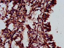 ELMOD3 Antibody - Immunohistochemistry image at a dilution of 1:500 and staining in paraffin-embedded human lung tissue performed on a Leica BondTM system. After dewaxing and hydration, antigen retrieval was mediated by high pressure in a citrate buffer (pH 6.0) . Section was blocked with 10% normal goat serum 30min at RT. Then primary antibody (1% BSA) was incubated at 4 °C overnight. The primary is detected by a biotinylated secondary antibody and visualized using an HRP conjugated SP system.